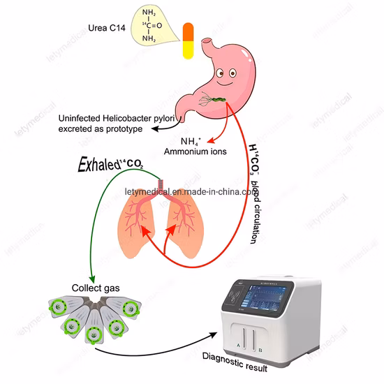 Test del respiro con urea H. Pylori C13